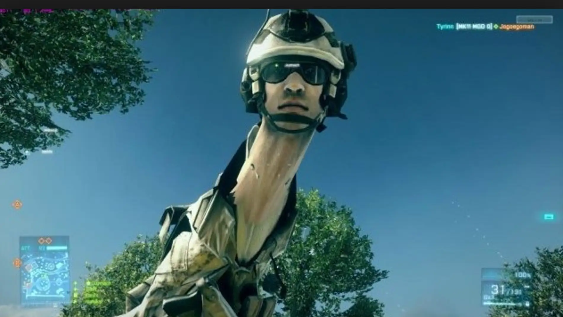 Hombre Jirafa