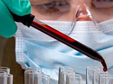 Una gota de sangre para descubrir los virus que han infectado a una persona   Una gota de sangre para descubrir los virus que han infectado a una persona