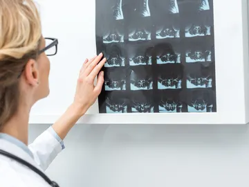 Los videojuegos se meten de lleno en la prevención del cáncer y tu puedes participar Los videojuegos se meten de lleno en la prevención del cáncer y tu puedes participar